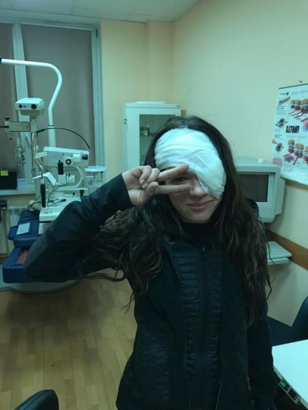 Без глаза: Руслана показала, что с ней сделали в больнице