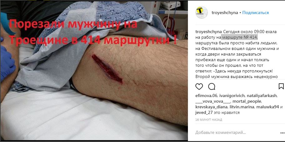 В Киеве мужчину ударили ножом за отказ подвинуться в переполненной маршрутке (Фото, 18+)
