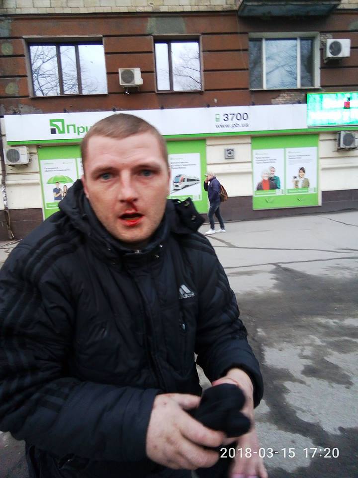 Тупой карманник попал под руку разъяренных украинцев: фото 18+