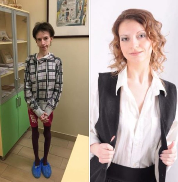 До костей: ужасная история девушки шокировала украинцев