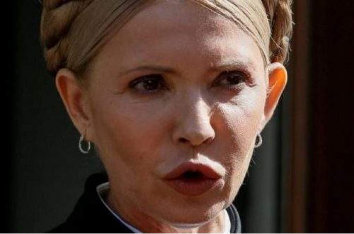 Один с Тимошенко хирург делал: фото скандальной экс-регионалки шокировало украинцев
