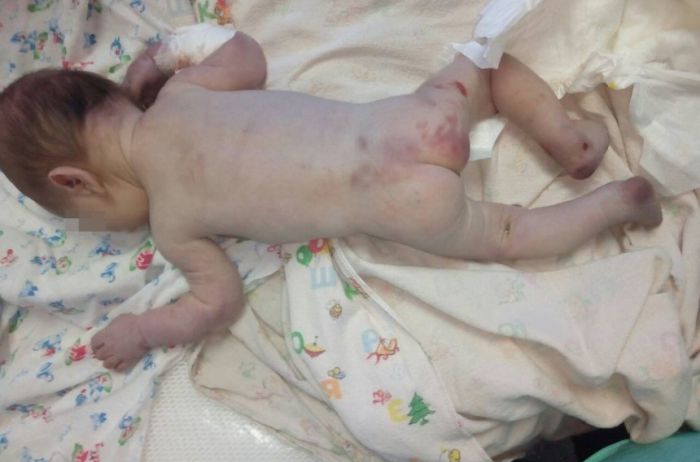 Скончался малыш, подброшенный врачам в коробке на Николаевщине