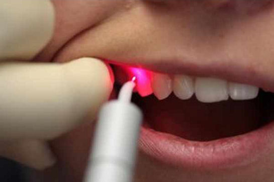 Лазер – оружие дантиста: сферы применения в стоматологии