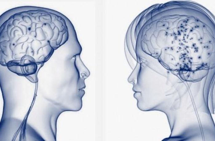 Ученые назвали 20 отличий мужского и женского мозга
