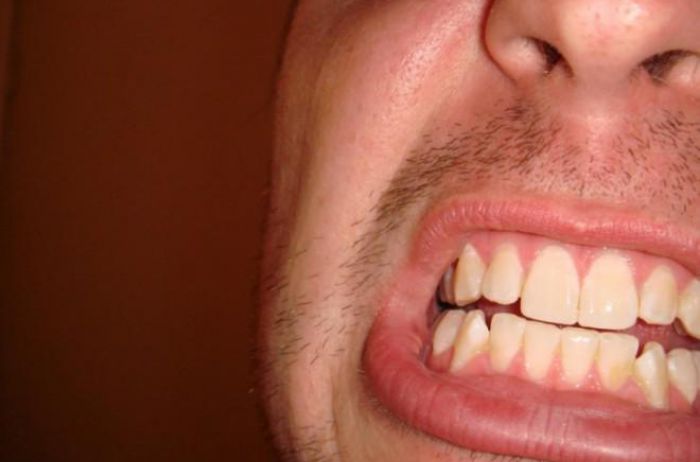 Назван самый помогающий метод от зубной боли